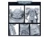 McFarlane Toys: Chaos Space Marine (Artist Proof) (предзаказ 2022)